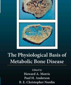 The Physiological Basis of Metabolic Bone Disease ebook