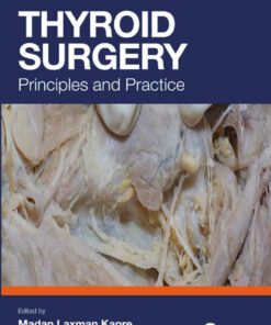 Thyroid Surgery: Principles and Practice ebook