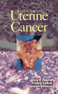 Uterine Cancer ebook