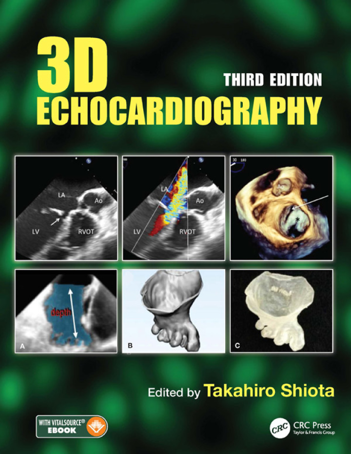 3D Echocardiography ebook