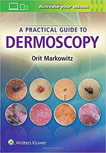A Practical Guide to Dermoscopy ebook