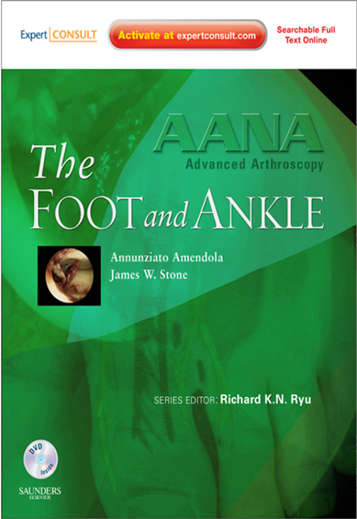 AANA Advanced Arthroscopy: The Foot and Ankle - Electronic ebook