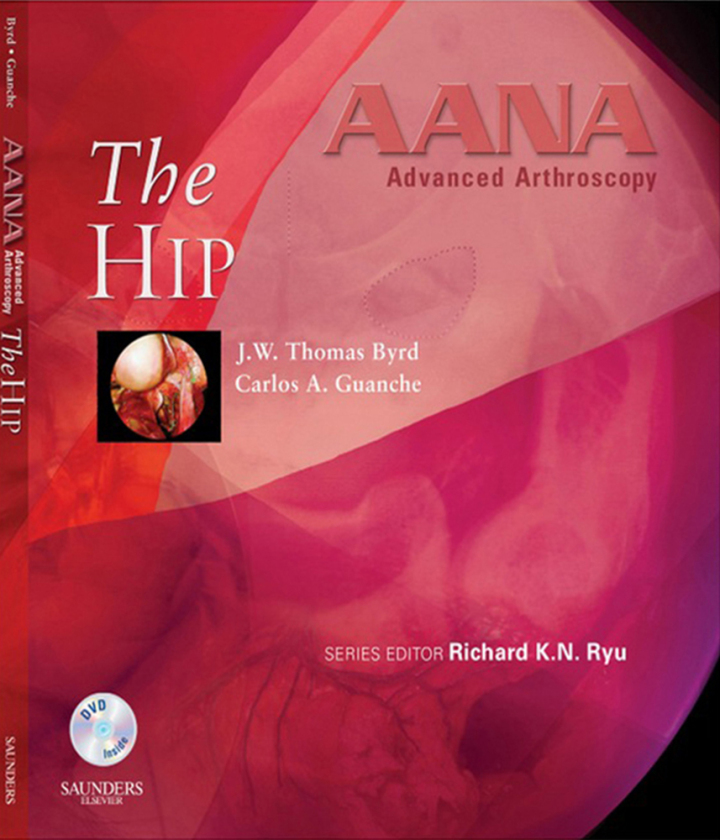 AANA Advanced Arthroscopy: The Hip ebook