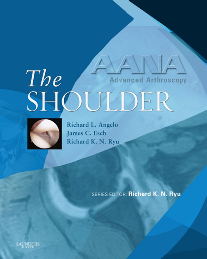 AANA Advanced Arthroscopy: The Shoulder - Electronic ebook