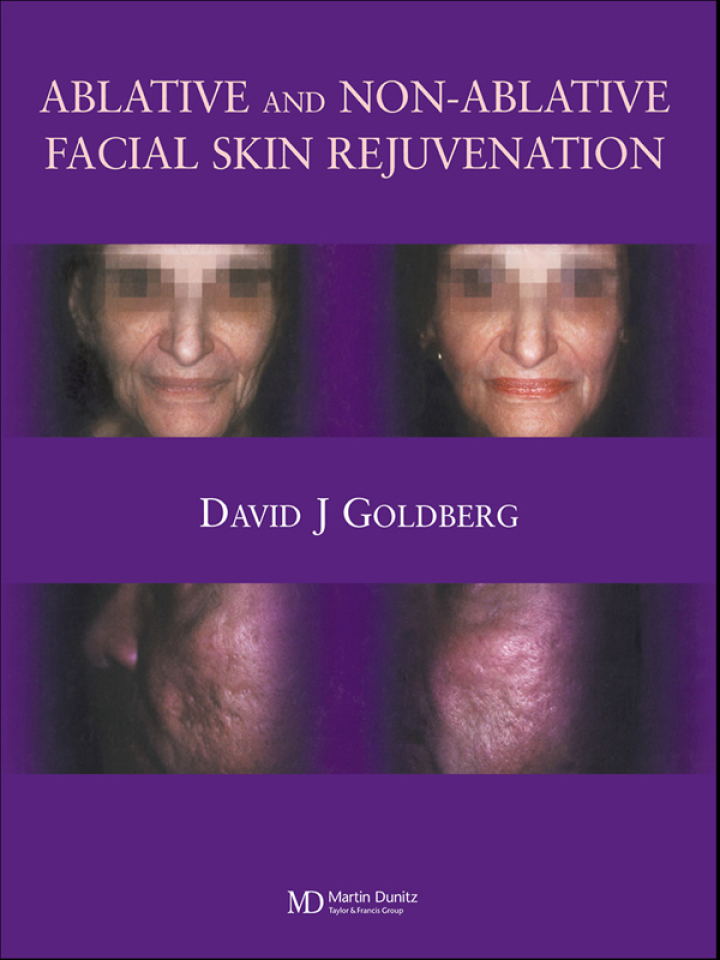 Ablative and Non-ablative Facial Skin Rejuvenation ebook