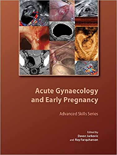 Acute Gynaecology and Early Pregnancy ebook