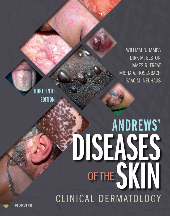 Andrews' Diseases of the Skin Clinical Dermatology ebook