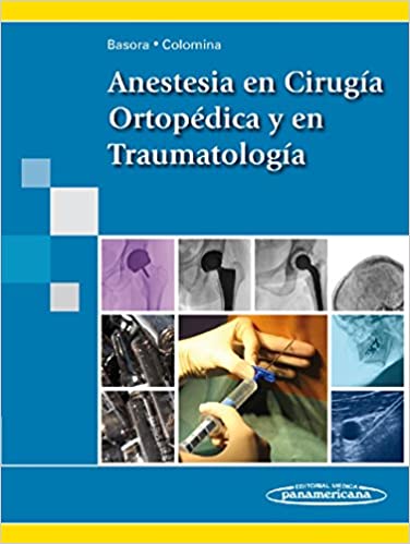 Anestesia en cirug�a ortop�dica y en traumatolog�a ebook