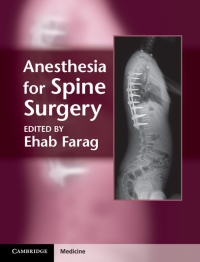 Anesthesia for Spine Surgery ebook