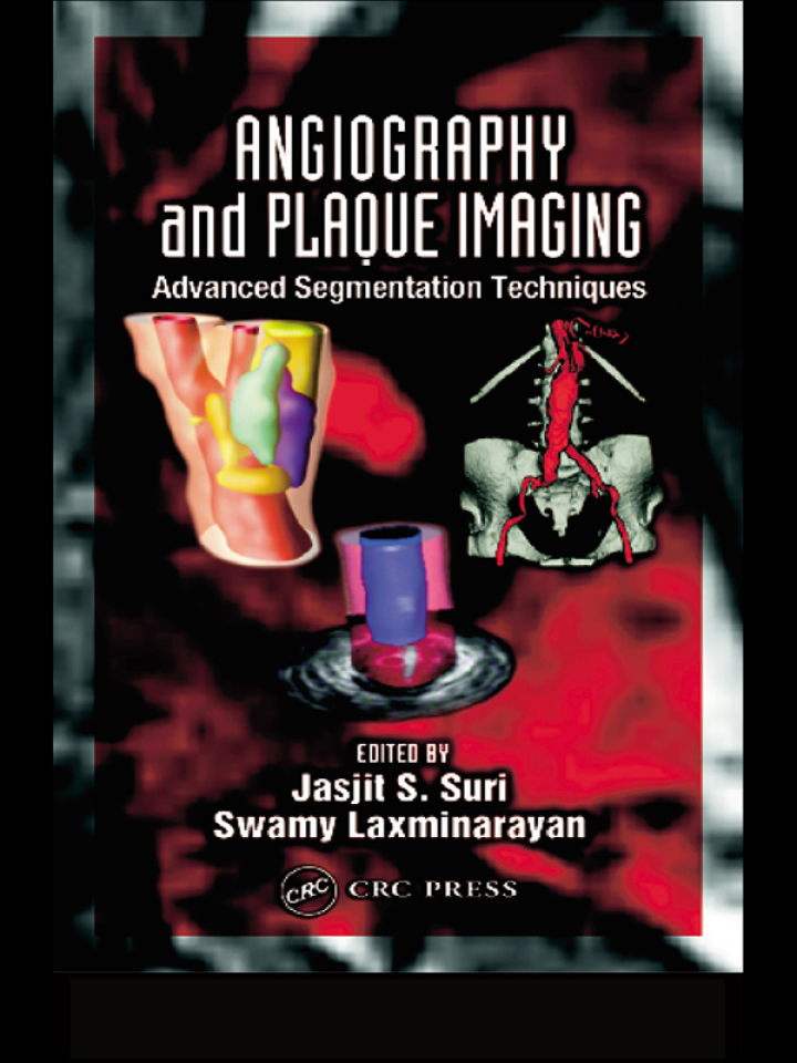 Angiography and Plaque Imaging: Advanced Segmentation Techniques ebook