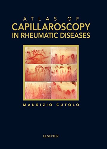 Atlas of capillaroscopy in rheumatic diseases ebook