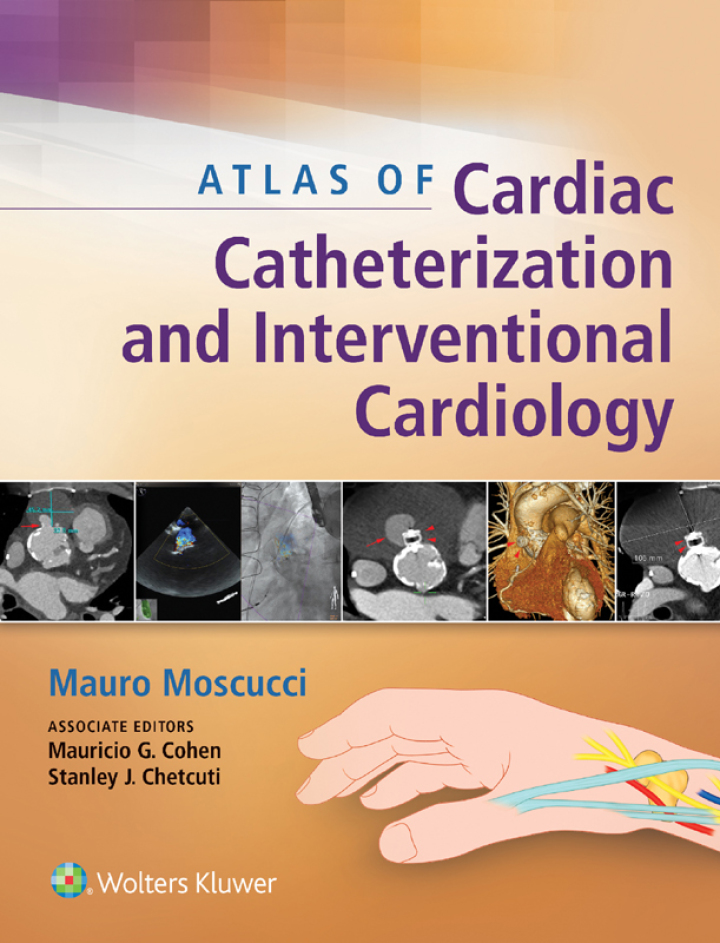 Atlas of Cardiac Catheterization and Interventional Cardiology ebook