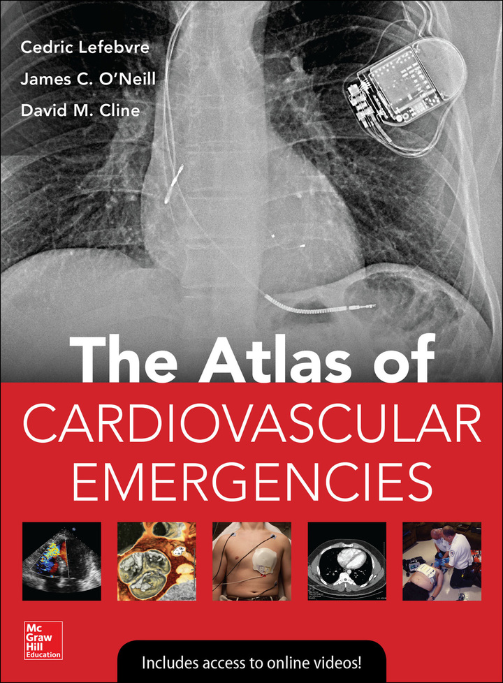 Atlas of Cardiovascular Emergencies ebook