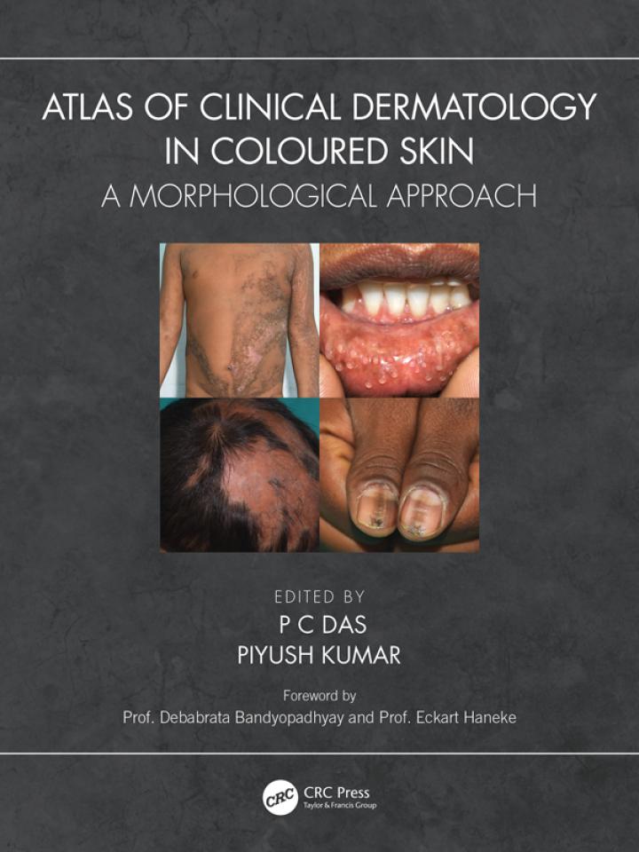 Atlas of Clinical Dermatology in Coloured Skin: A Morphological Approach ebook