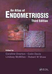 Atlas of Endometriosis ebook