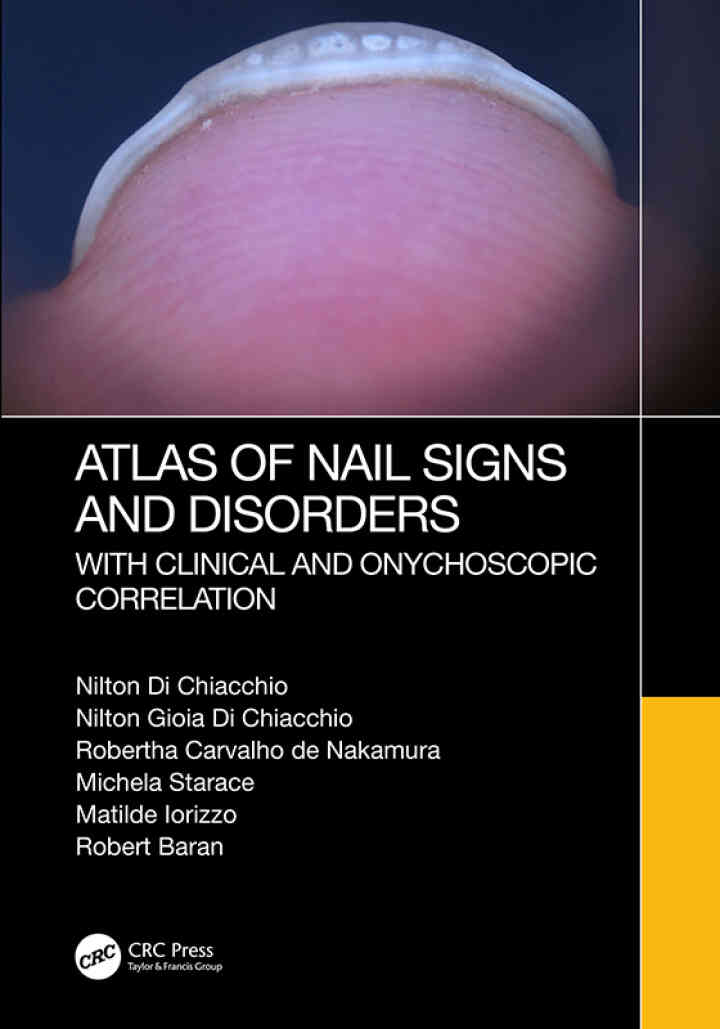 Atlas of Nail Signs and Disorders with Clinical and Onychoscopic Correlation ebook