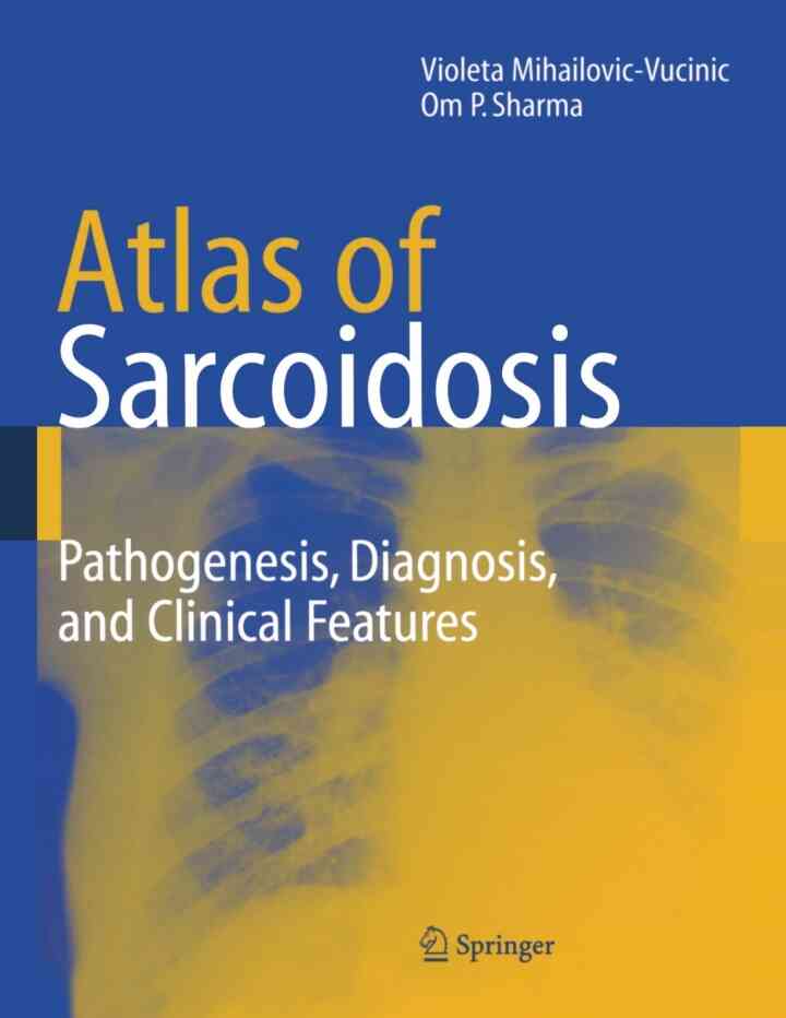 Atlas of Sarcoidosis: Pathogenesis, Diagnosis and Clinical Features ebook