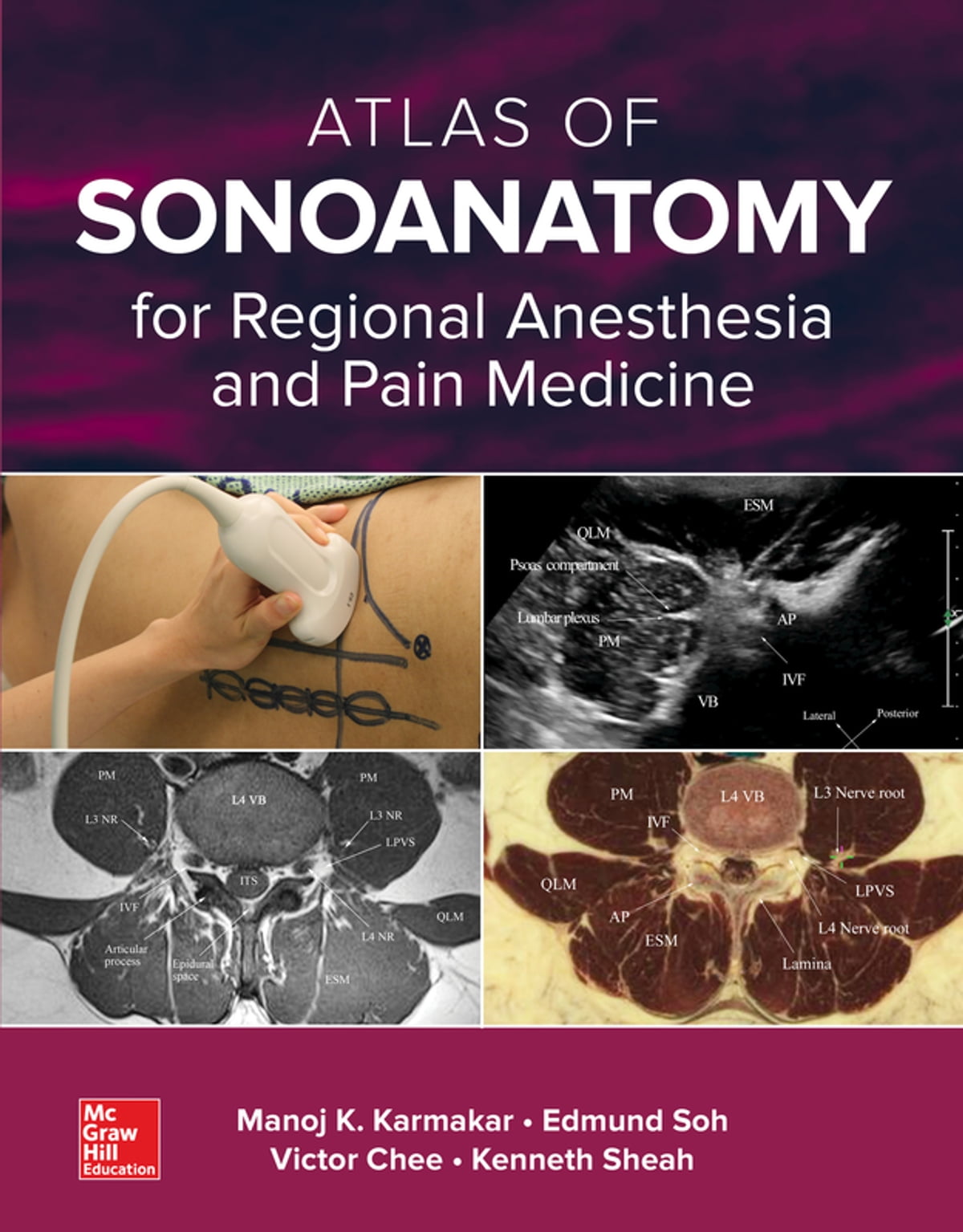 Atlas of Sonoanatomy for Regional Anesthesia and Pain Medicine ebook