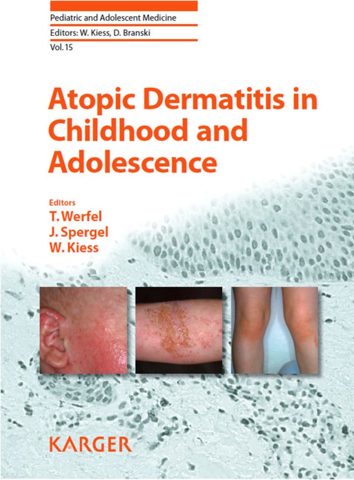 Atopic Dermatitis in Childhood and Adolescence ebook