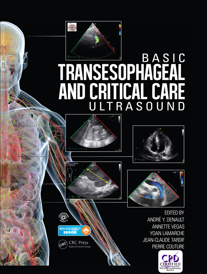 Basic Transesophageal and Critical Care Ultrasound ebook