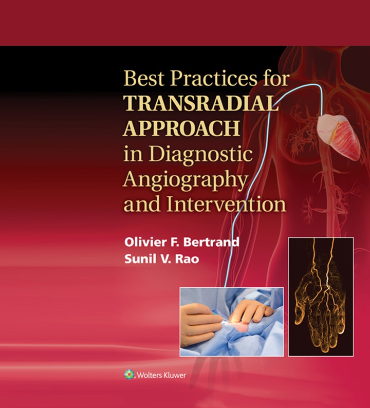 Best Practices for Transradial Approach in Diagnostic Angiography and Intervention ebook
