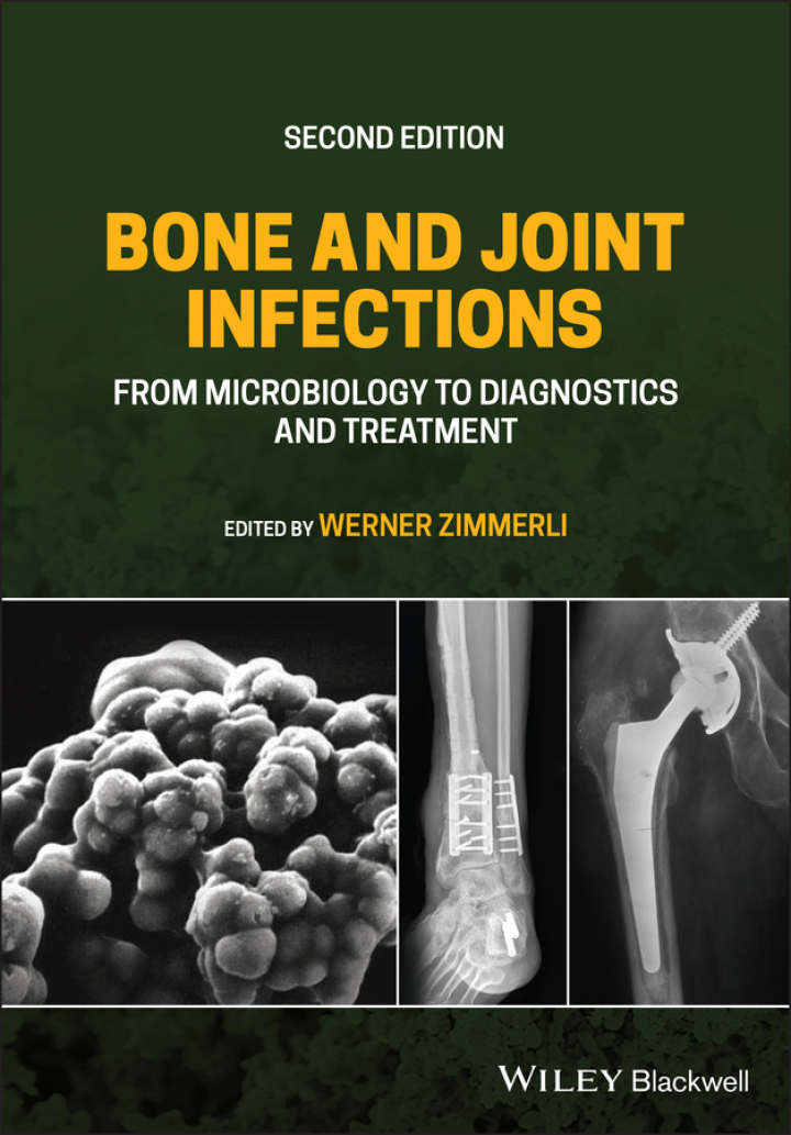 Bone and Joint Infections: From Microbiology to Diagnostics and Treatment ebook