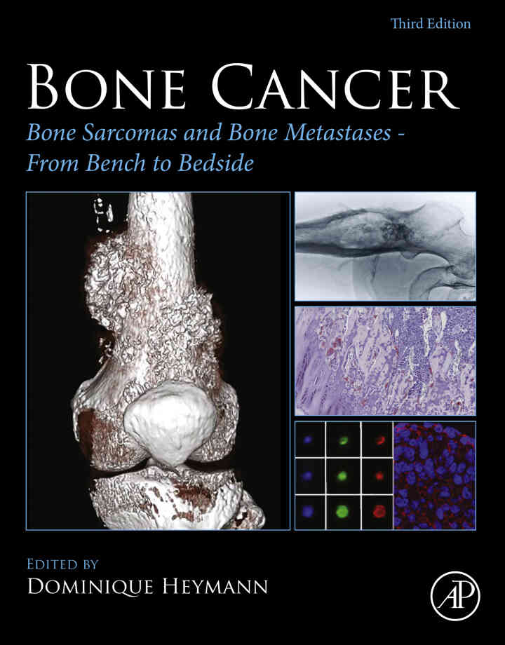 Bone Cancer: Bone Sarcomas and Bone Metastases - From Bench to Bedside ebook
