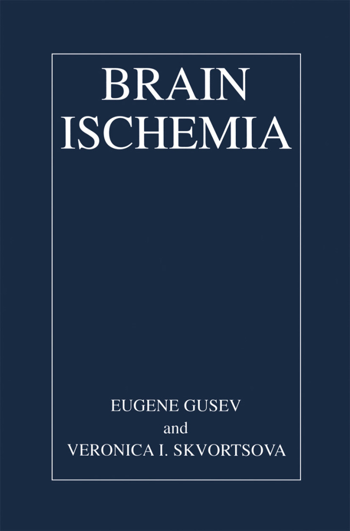 Brain Ischemia ebook