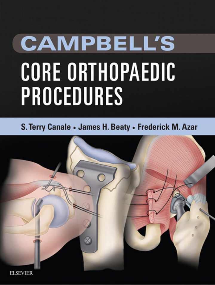 Campbell's Core Orthopaedic Procedures ebook