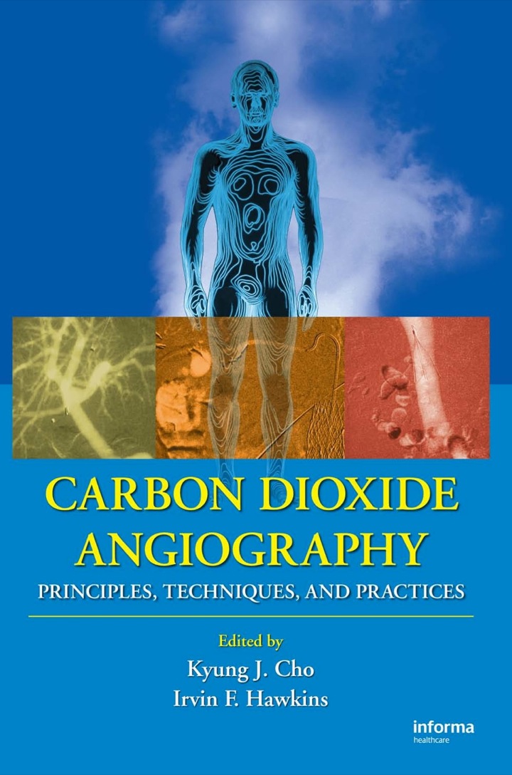 Carbon Dioxide Angiography: Principles, Techniques, and Practices ebook