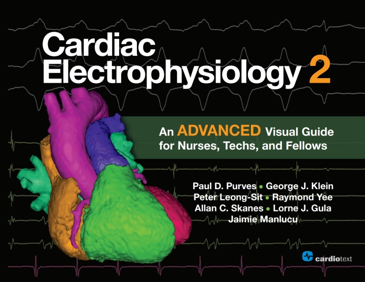 Cardiac Electrophysiology 2: An Advanced Visual Guide for Nurses, Techs, and Fellows ebook