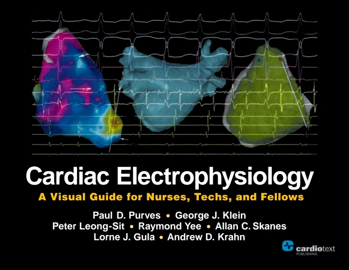 Cardiac Electrophysiology: A Visual Guide for Nurses, Techs, and Fellows ebook