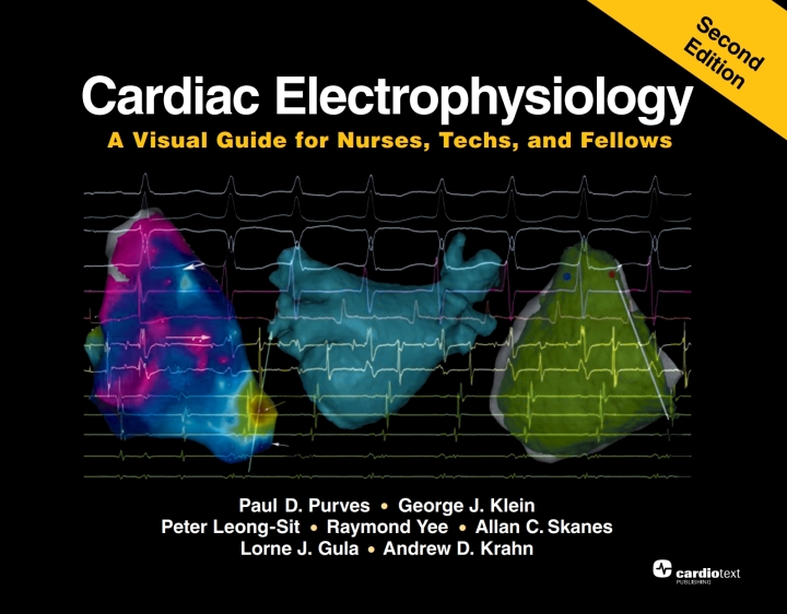 Cardiac Electrophysiology: A Visual Guide for Nurses, Techs, and Fellows, Second Edition ebook