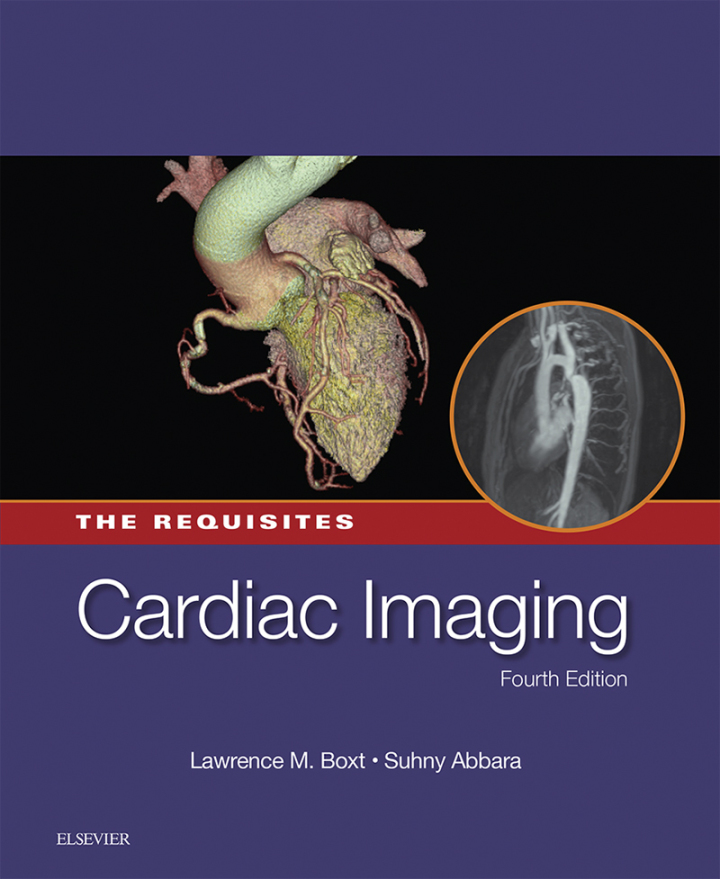Cardiac Imaging: The Requisites E-Book ebook