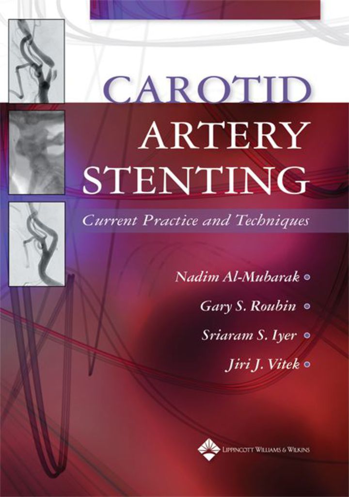 Carotid Artery Stenting: Current Practice and Techniques ebook