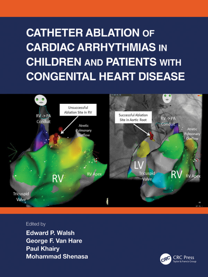 Catheter Ablation of Cardiac Arrhythmias in Children and Patients with Congenital Heart Disease ebook
