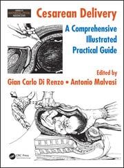 Cesarean Delivery: A Comprehensive Illustrated Practical Guide ebook