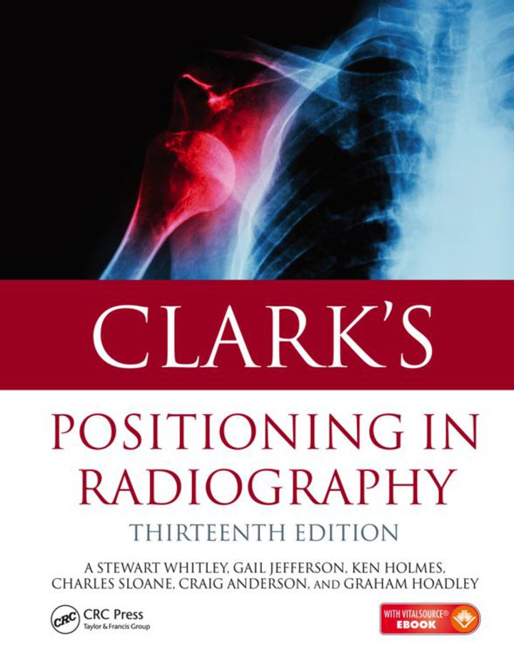 Clark's Positioning in Radiography 13E  ebook