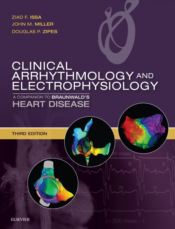Clinical Arrhythmology and Electrophysiology E-Book: A Companion to Braunwald's Heart Disease ebook