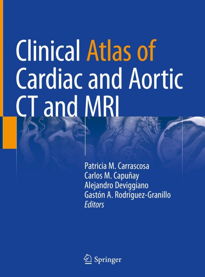 Clinical Atlas of Cardiac and Aortic CT and MRI ebook