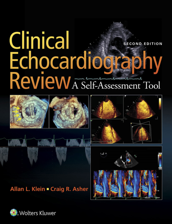 Clinical Echocardiography Review ebook
