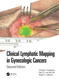 Clinical Lymphatic Mapping in Gynecologic Cancers ebook