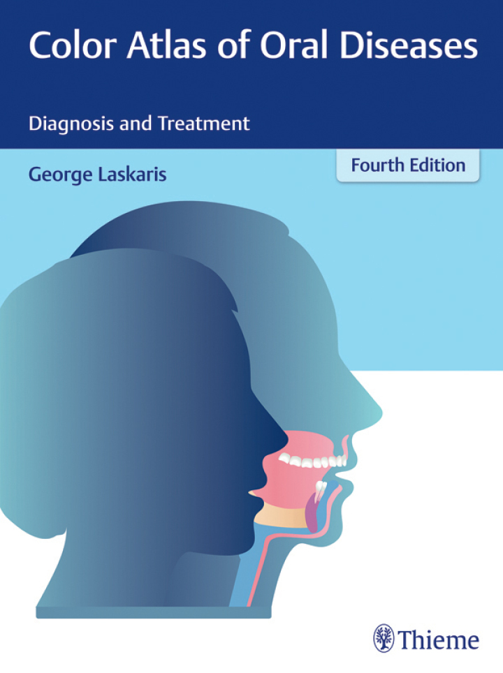 Color Atlas of Oral Diseases: Diagnosis and Treatment ebook