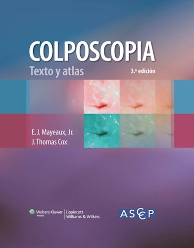 Colposcopia. Texto y atlas ebook