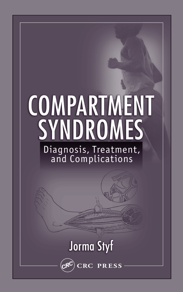 Compartment Syndromes: Diagnosis, Treatment, and Complications ebook