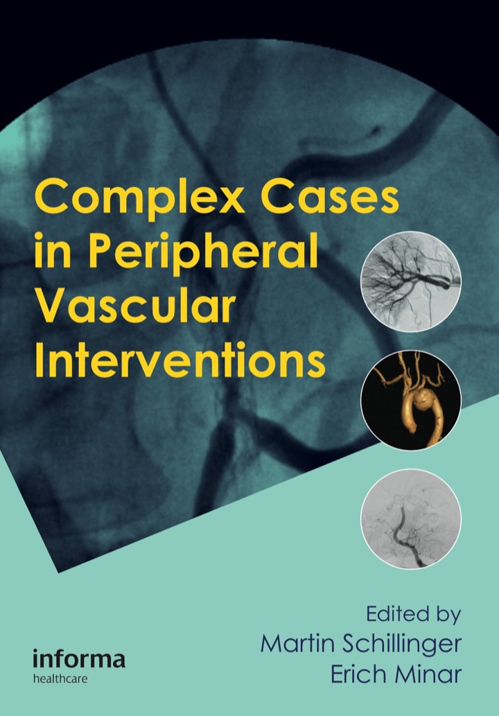 Complex Cases in Peripheral Vascular Interventions ebook