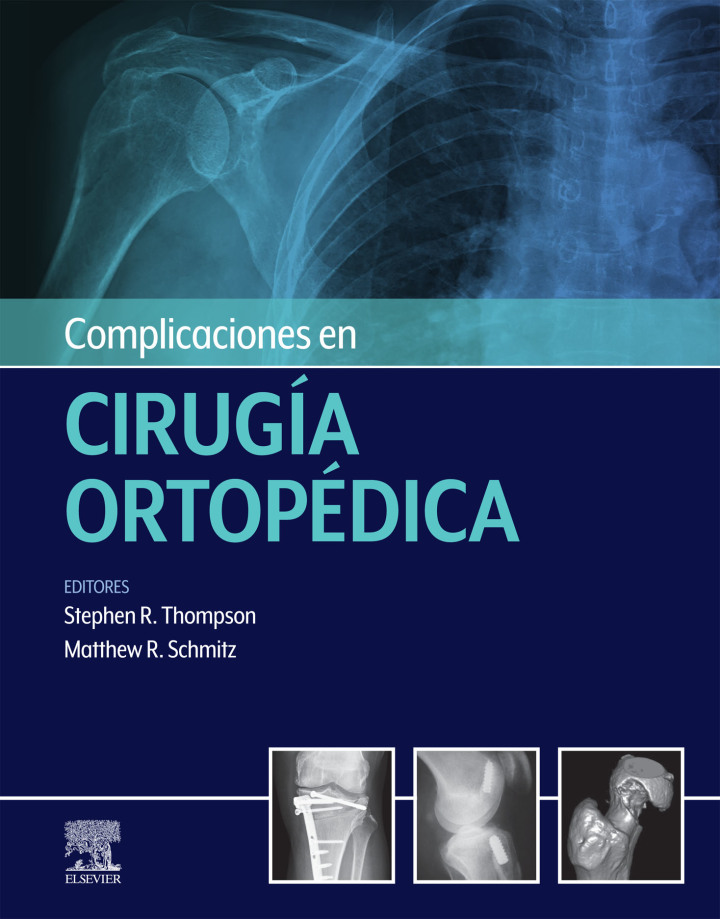 Complicaciones en cirug�a ortop�dica: Medicina deportiva ebook