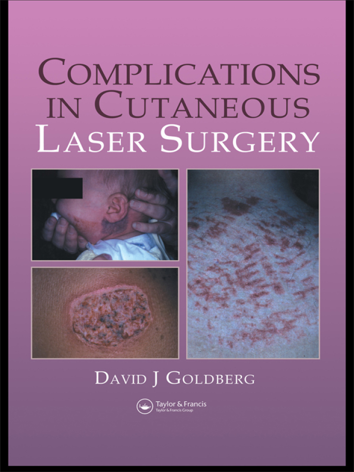 Complications in Laser Cutaneous Surgery ebook