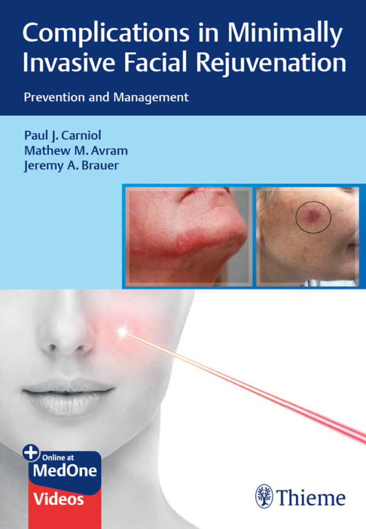 Complications in Minimally Invasive Facial Rejuvenation: Prevention and Management ebook