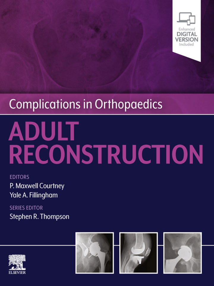 Complications in Orthopaedics: Adult Reconstruction - E-Book ebook